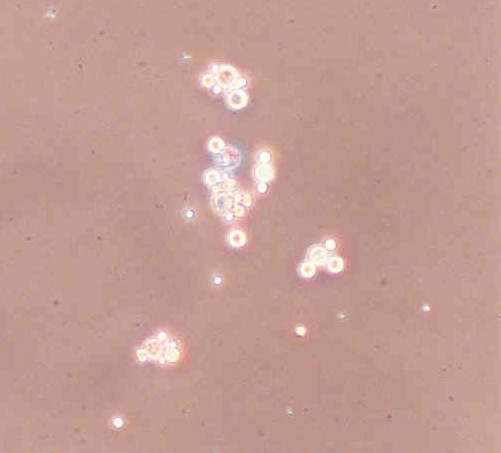 Yeast